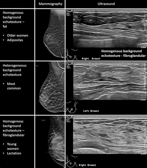 the villages breast ultrasound|Breast Ultrasound: Purpose, Results, Next Steps, and .